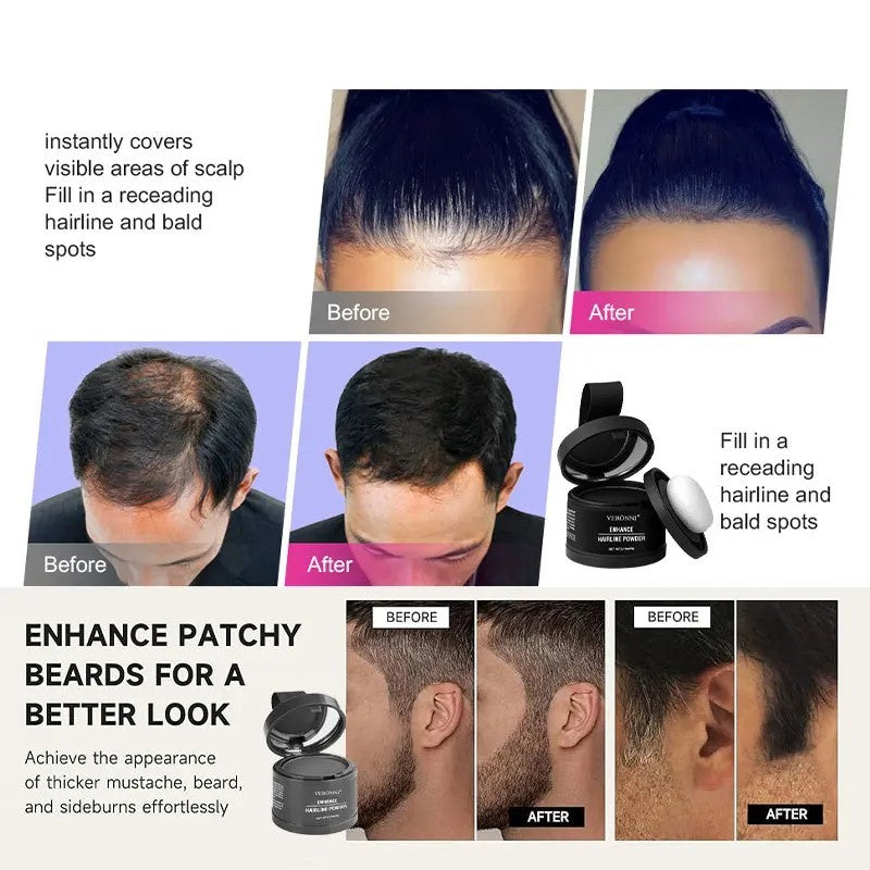 Veronni Professional Hairline - Instantly Fills Bald Spots in Seconds✨