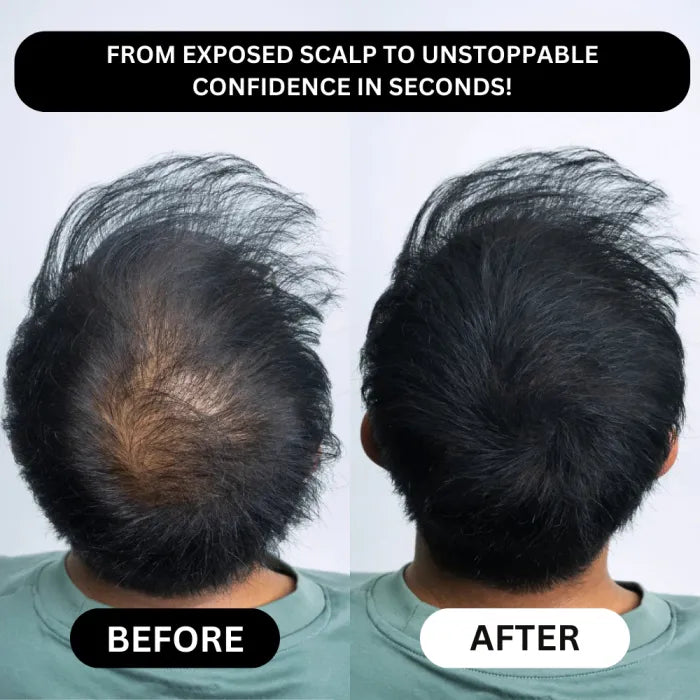 Veronni Professional Hairline - Instantly Fills Bald Spots in Second