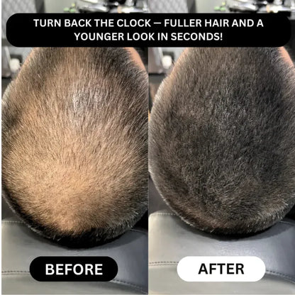 Veronni Professional Hairline - Instantly Fills Bald Spots in Seconds✨