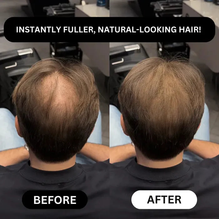 Veronni Professional Hairline - Instantly Fills Bald Spots in Second
